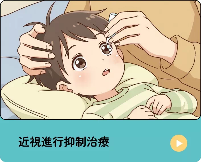 円錐角膜に対するハードコンタクトレンズ